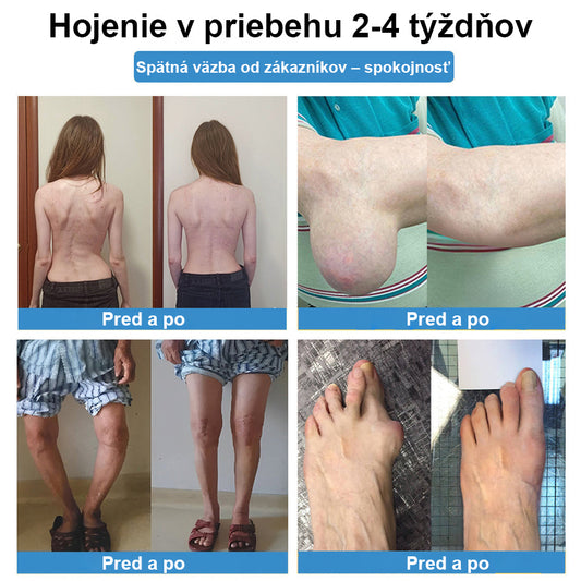 CieraNaure® kĺbová náplasť s nano-ihličkami