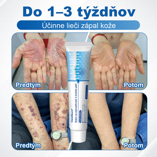 CleraNaure® jemný regeneračný krém na pokožku 🌿 Viacnásobná regenerácia – proti modrinám, suchosti a škvrnám