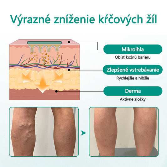 CleraNature® LegRenew Náplasti na kŕčové žily