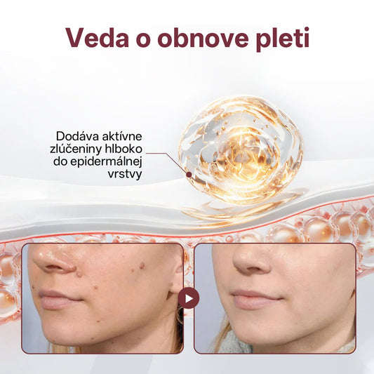 CleraNaure® OryzaClear – Obnovujúci krém s čiernou ryžou proti kožným výrastkom a hrbolčekom · Jemné rastlinné zjemnenie