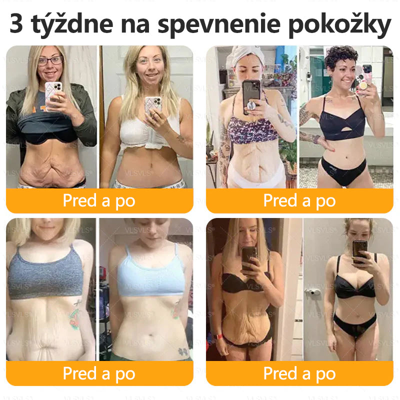 CleraNaure® Krém na obnovu pokožky s včelím jedom