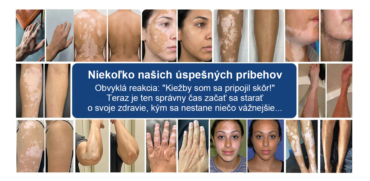 CleraNature® Piperine Repigment Aktivátor Sprej, ktorý aktivuje spiace pigmentové bunky a obnovuje prirodzenú farbu pleti.