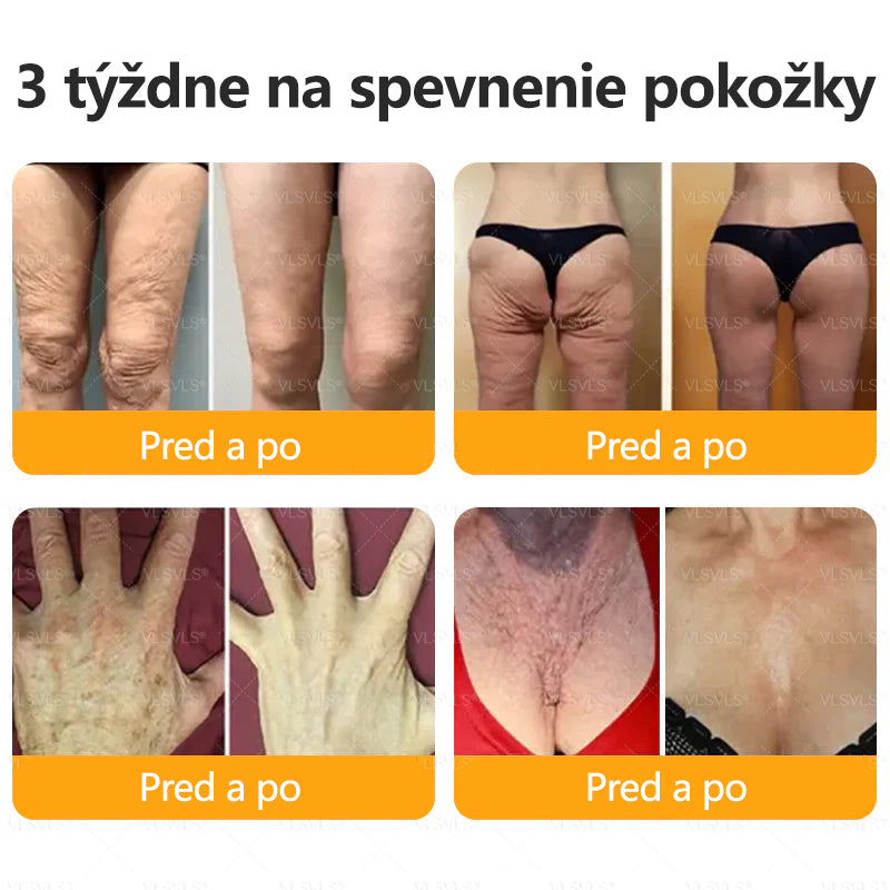 CleraNaure® Krém na obnovu pokožky s včelím jedom