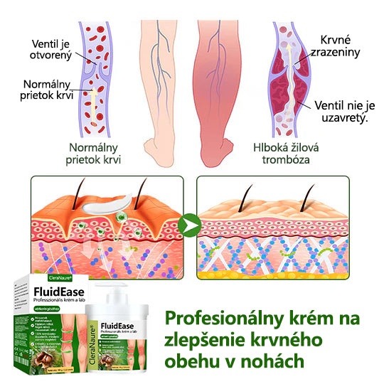 ✨Povedzte zbohom opuchnutým, boľavým nohám – CleraNaure® FluidEase Profesionálny krém na zlepšenie krvného obehu v nohách prináša skutočnú úľavu! ✨🦵