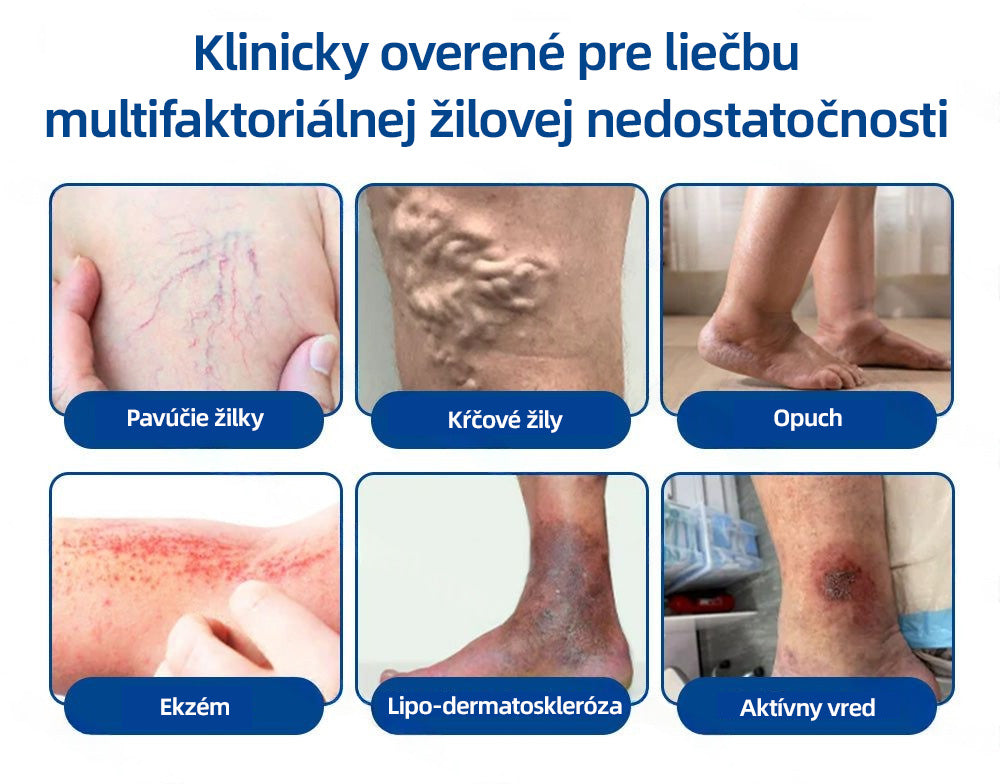 💙Healrize® VeinTarget mikrojihlová náplasť