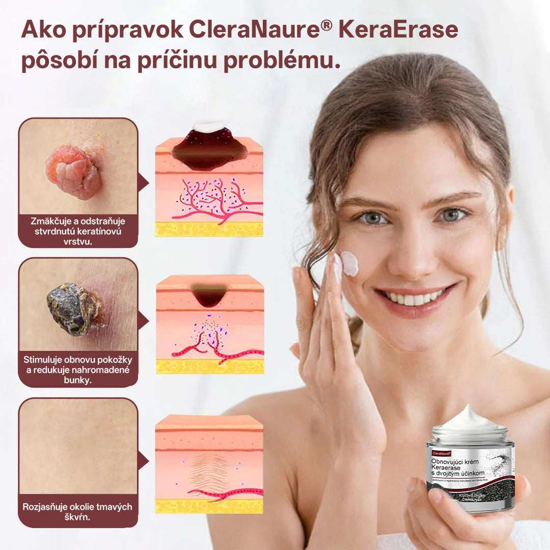 CleraNaure® OryzaClear – Obnovujúci krém s čiernou ryžou proti kožným výrastkom a hrbolčekom · Jemné rastlinné zjemnenie