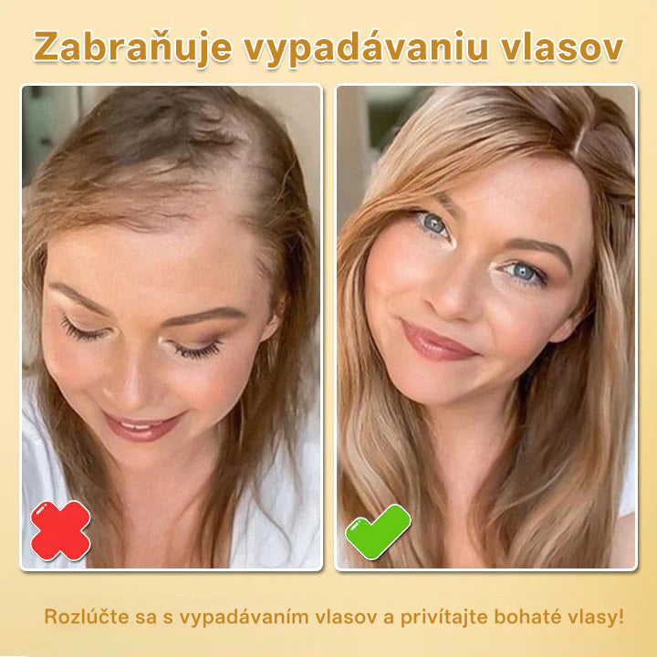 CleraNaure® Biotin Hair Growth Essence Spray (Nové zloženie)