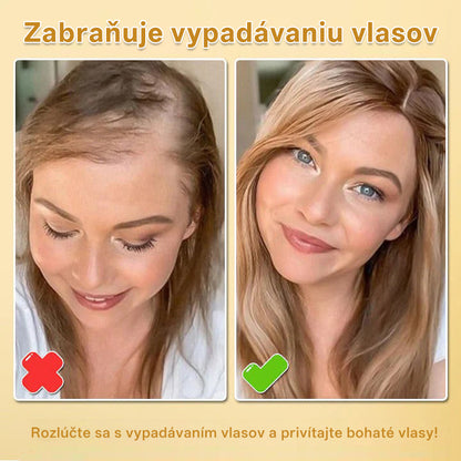 CleraNaure® Biotin Hair Growth Essence Spray (Nové zloženie)