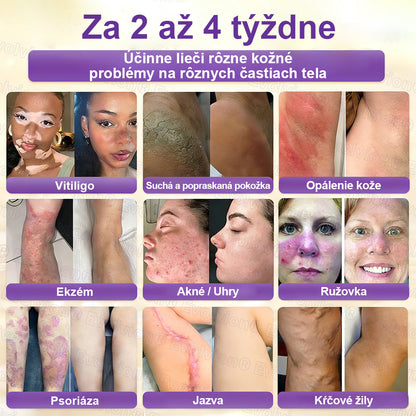 🥇CleraNaure® Biotin 10-v-1 Kožný Regeneračný Krém