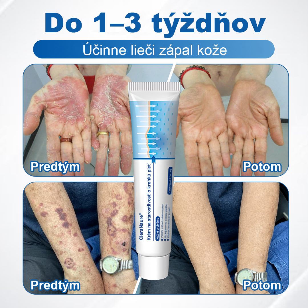 CleraNaure® jemný regeneračný krém na pokožku 🌿 Viacnásobná regenerácia – proti modrinám, suchosti a škvrnám