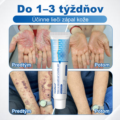 CleraNaure® jemný regeneračný krém na pokožku 🌿 Viacnásobná regenerácia – proti modrinám, suchosti a škvrnám