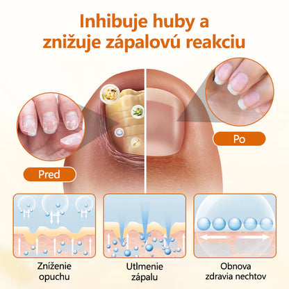 CleraNature® FungiBee Pokročilý sprej na opravu nechtov