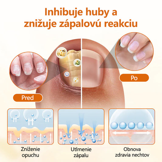 CleraNature® FungiBee Pokročilý sprej na opravu nechtov