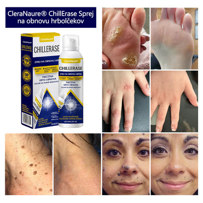 💎CleraNature® ChillErase sprej na obnovu hrbolčekov