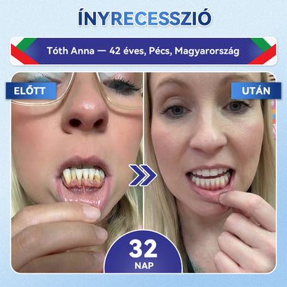 🦷 CleraNaure® Tideglusib Zubná a ďasnová opravná mikronáplasť | Pokročilé mikropásiky aktivujúce kmeňové bunky (obnovuje zubnú sklovinu a dentín • posilňuje ďasná • odstraňuje zubný kameň a zápach • zastavuje citlivosť zubov) 3.0
