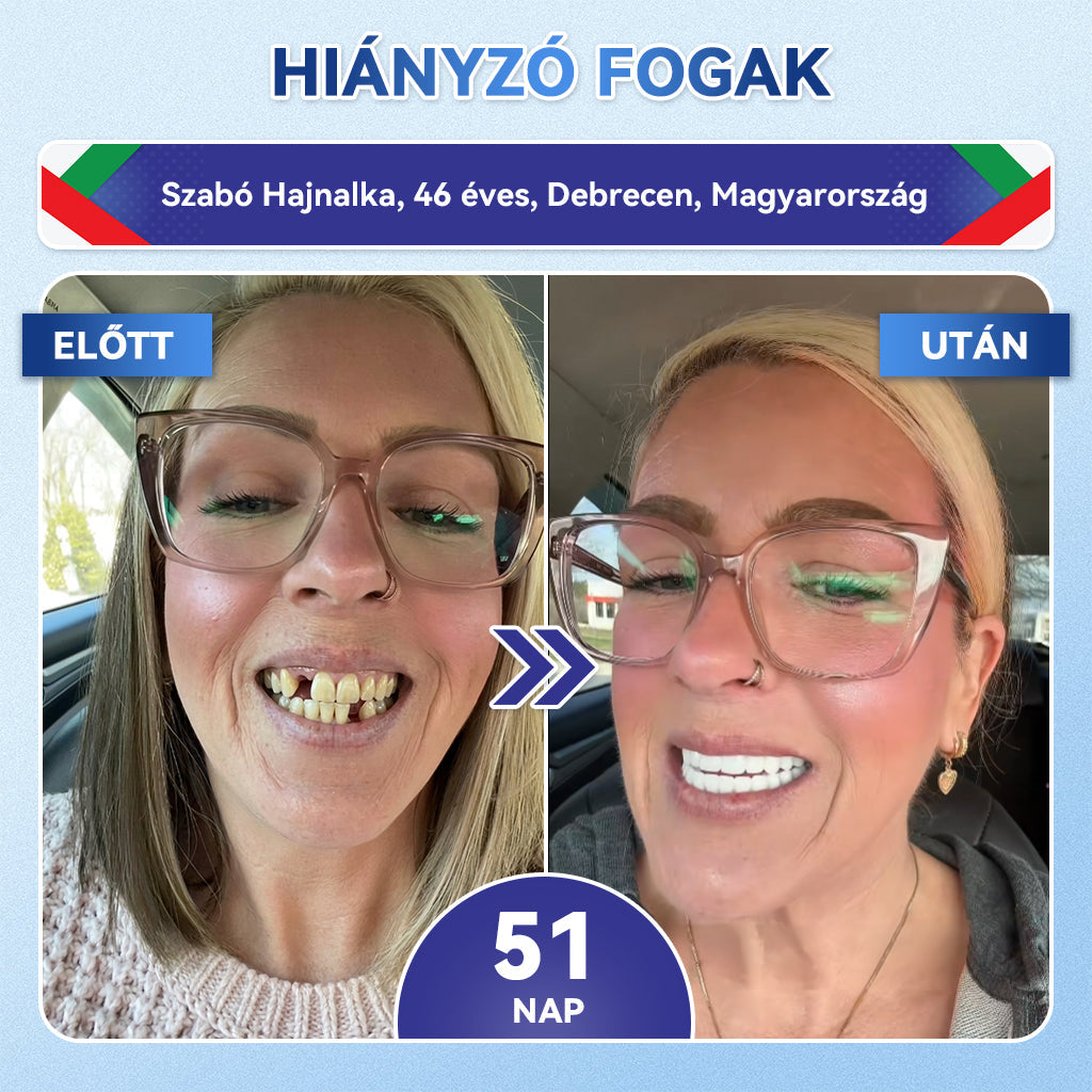 🦷 CleraNaure® Tideglusib Zubná a ďasnová opravná mikronáplasť | Pokročilé mikropásiky aktivujúce kmeňové bunky (obnovuje zubnú sklovinu a dentín • posilňuje ďasná • odstraňuje zubný kameň a zápach • zastavuje citlivosť zubov) 3.0