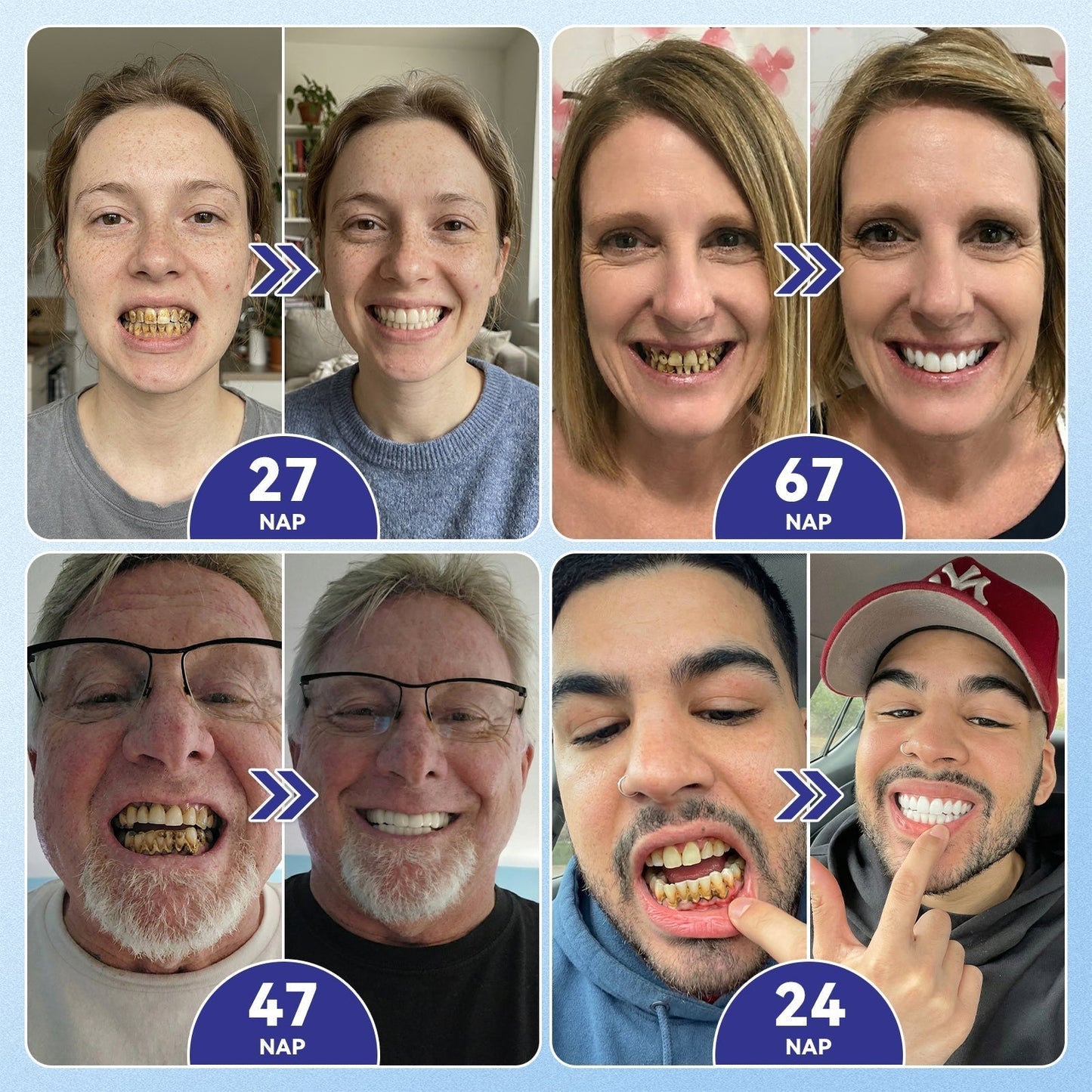 🦷 CleraNaure® Tideglusib Zubná a ďasnová opravná mikronáplasť | Pokročilé mikropásiky aktivujúce kmeňové bunky (obnovuje zubnú sklovinu a dentín • posilňuje ďasná • odstraňuje zubný kameň a zápach • zastavuje citlivosť zubov) 3.0