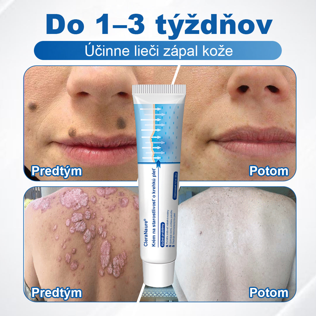 CleraNaure® jemný regeneračný krém na pokožku 🌿 Viacnásobná regenerácia – proti modrinám, suchosti a škvrnám