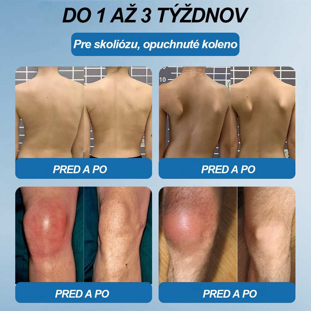 🥇 Posledný deň akcie 80% ZĽAVA | 🇸🇰 CleraNature® BPC-157 Krém na hojenie kĺbov 🦴 Lieči artritídu, neuropatiu, reumatizmus, športové zranenia a ďalšie