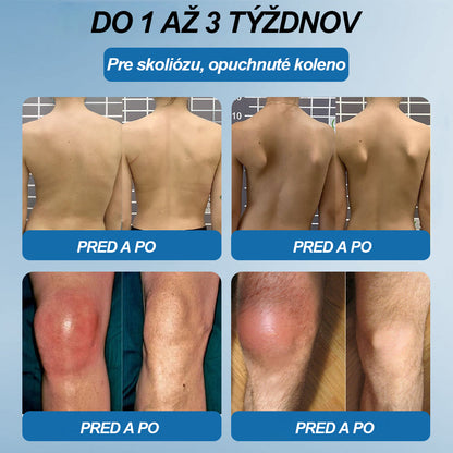 🥇 Posledný deň akcie 80% ZĽAVA | 🇸🇰 CleraNature® BPC-157 Krém na hojenie kĺbov 🦴 Lieči artritídu, neuropatiu, reumatizmus, športové zranenia a ďalšie