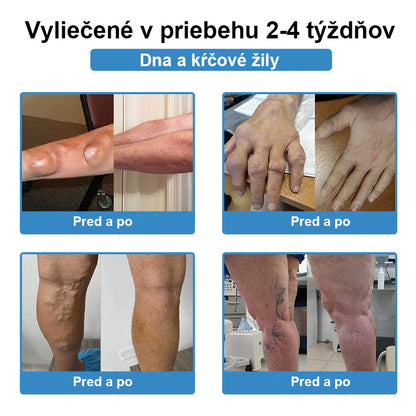 🏅CieraNaure® kĺbová náplasť s nano-ihličkami