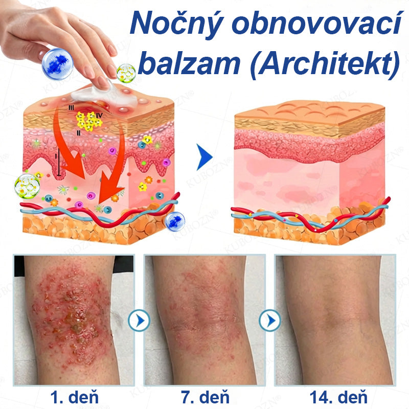 🥇CleraNaure® Ekzémový deň a noc regeneračný systém – 100% bezsteroidné duo na intenzívne svrbenie, začervenanie a porušenú pokožku (akcia)