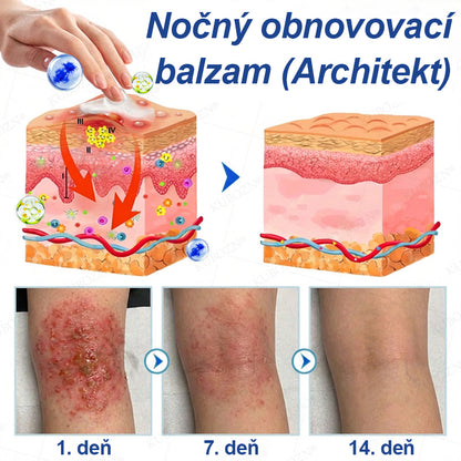🥇CleraNaure® Ekzémový deň a noc regeneračný systém – 100% bezsteroidné duo na intenzívne svrbenie, začervenanie a porušenú pokožku (akcia)