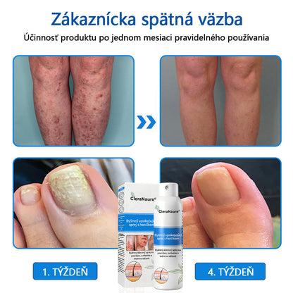 ClereNature® Magnesium Spray – Rýchla úľava pre svrbivú, červenú a citlivú pokožku (aj intímne oblasti)