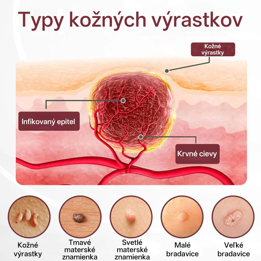 CleraNaure® OryzaClear – Obnovujúci krém s čiernou ryžou proti kožným výrastkom a hrbolčekom · Jemné rastlinné zjemnenie