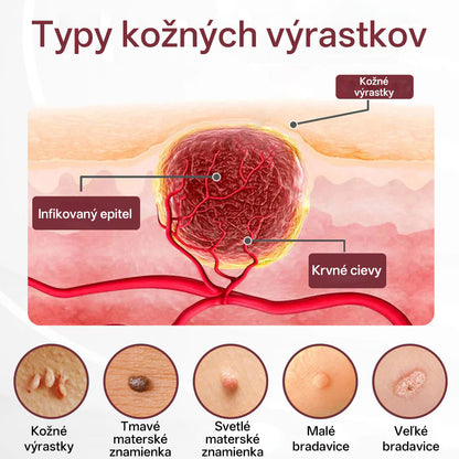 CleraNaure® OryzaClear – Obnovujúci krém s čiernou ryžou proti kožným výrastkom a hrbolčekom · Jemné rastlinné zjemnenie