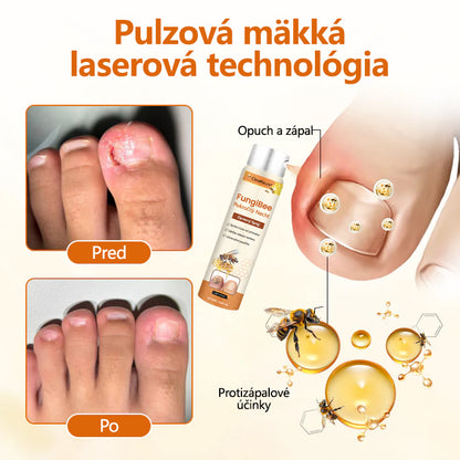 CleraNature® FungiBee Pokročilý sprej na opravu nechtov
