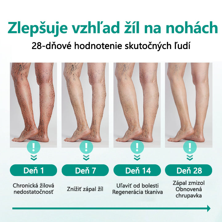 🛡️CleraNature® LegRenew Náplasti na kŕčové žily