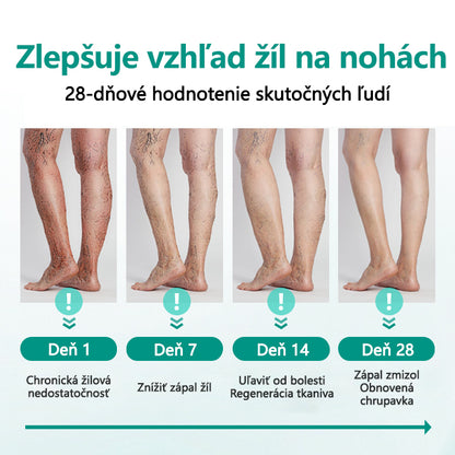 🛡️CleraNature® LegRenew Náplasti na kŕčové žily
