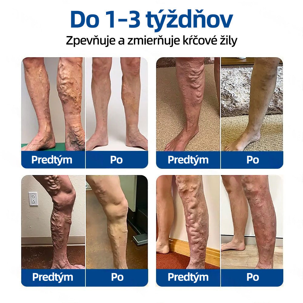 💙Healrize® VeinTarget mikrojihlová náplasť