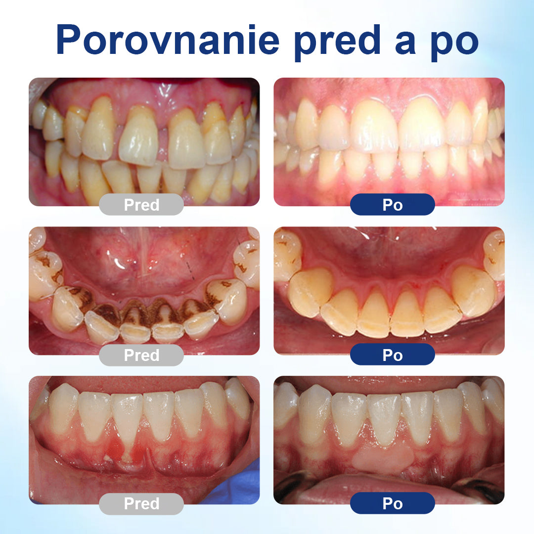 COLTURE® GumHoney kvapky na opravu ústnej dutiny