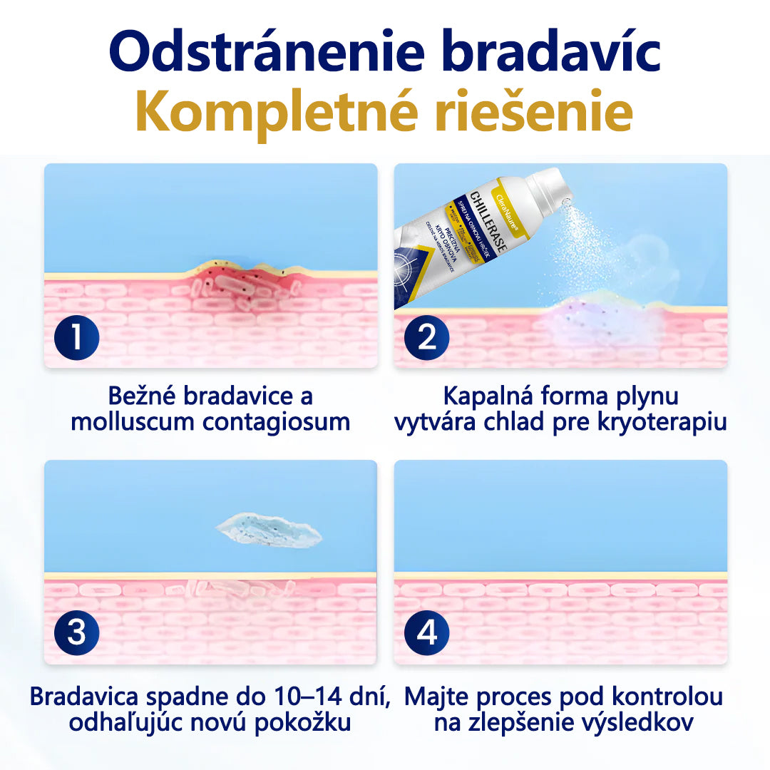 💎CleraNature® ChillErase sprej na obnovu hrbolčekov