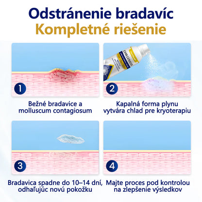 💎CleraNature® ChillErase sprej na obnovu hrbolčekov