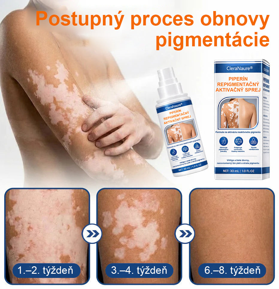 CleraNature® Piperine Repigment Aktivátor Sprej, ktorý aktivuje spiace pigmentové bunky a obnovuje prirodzenú farbu pleti.