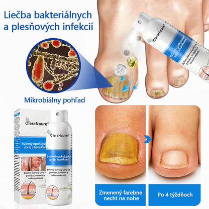 ClereNature® Magnesium Spray – Rýchla úľava pre svrbivú, červenú a citlivú pokožku (aj intímne oblasti)
