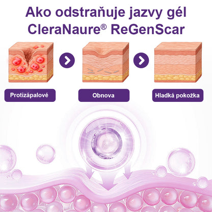 CleraNaure® ReGenScar – gél s kmeňovými bunkami na jazvy