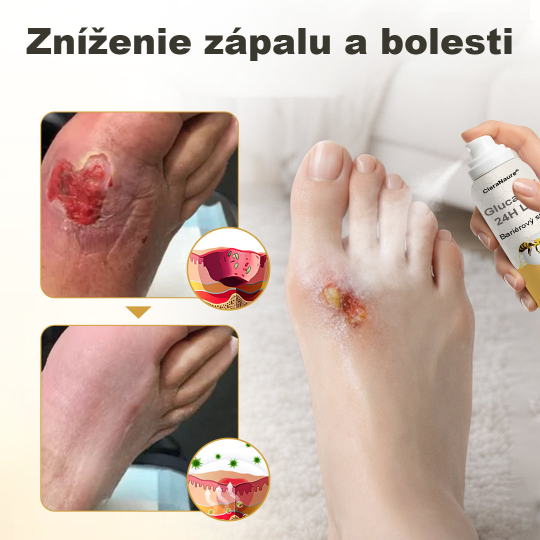 CleraNaure® GlucaVeil 24H Спрей за защита на краката