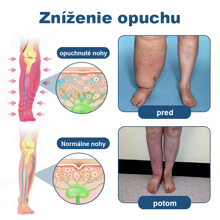 CleraNaure® Valčekový pumpovací krém na lymfodrenáž a úľavu od opuchov