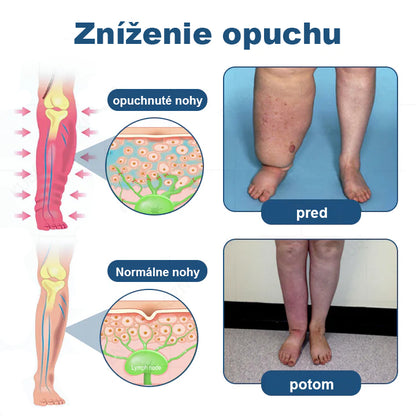 CleraNaure® Valčekový pumpovací krém na lymfodrenáž a úľavu od opuchov