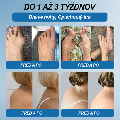 🥇 Posledný deň akcie 80% ZĽAVA | 🇸🇰 CleraNature® BPC-157 Krém na hojenie kĺbov 🦴 Lieči artritídu, neuropatiu, reumatizmus, športové zranenia a ďalšie