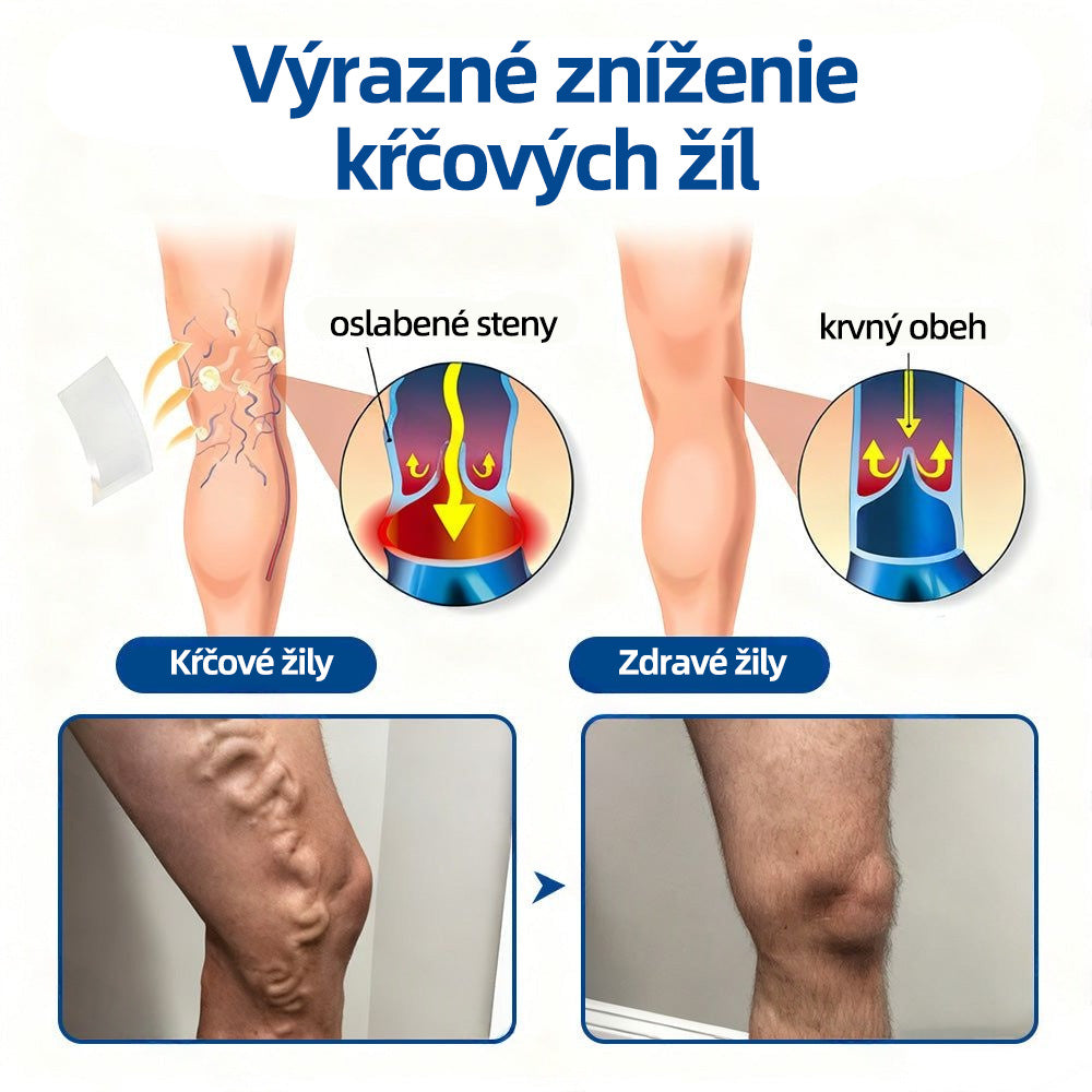 💙Healrize® VeinTarget mikrojihlová náplasť