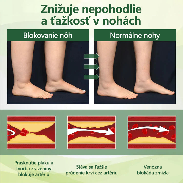 ✨Povedzte zbohom opuchnutým, boľavým nohám – CleraNaure® FluidEase Profesionálny krém na zlepšenie krvného obehu v nohách prináša skutočnú úľavu! ✨🦵