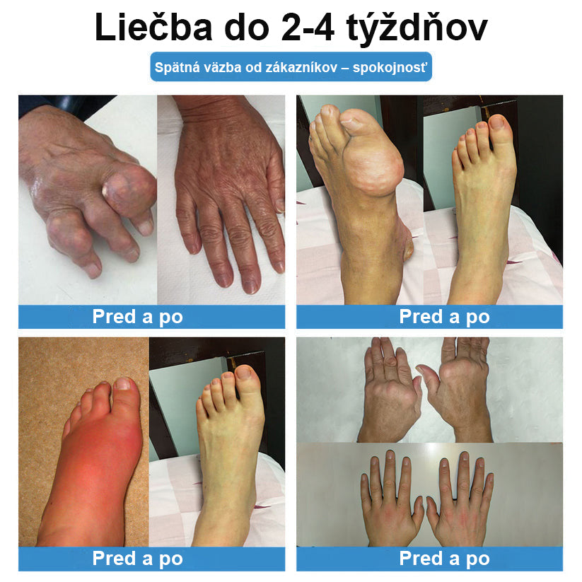 🏅CieraNaure® kĺbová náplasť s nano-ihličkami