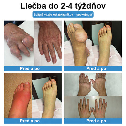 🏅CieraNaure® kĺbová náplasť s nano-ihličkami