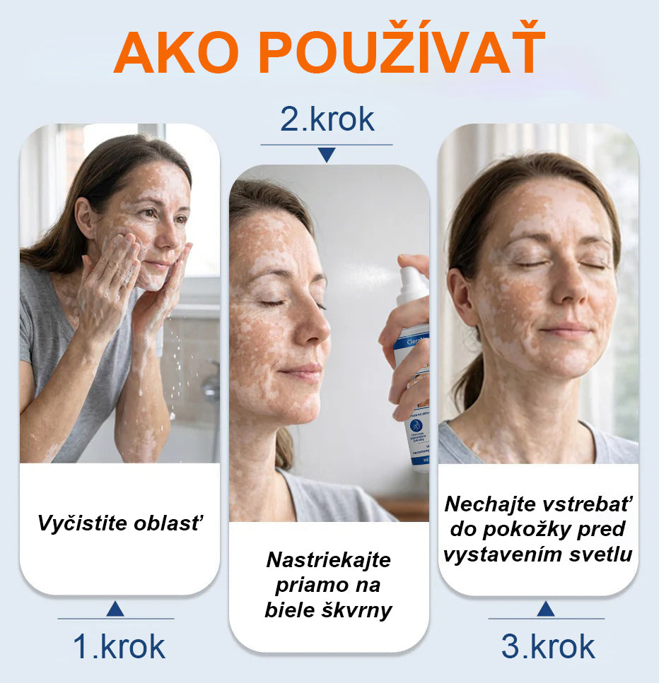 CleraNature® Piperine Repigment Aktivátor Sprej, ktorý aktivuje spiace pigmentové bunky a obnovuje prirodzenú farbu pleti.