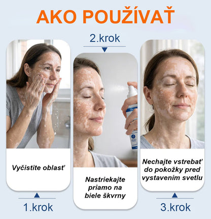 CleraNature® Piperine Repigment Aktivátor Sprej, ktorý aktivuje spiace pigmentové bunky a obnovuje prirodzenú farbu pleti.